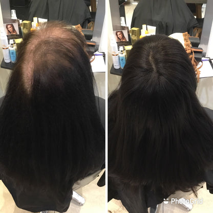 Amy | 100% Remy Hair Topper | Before and After