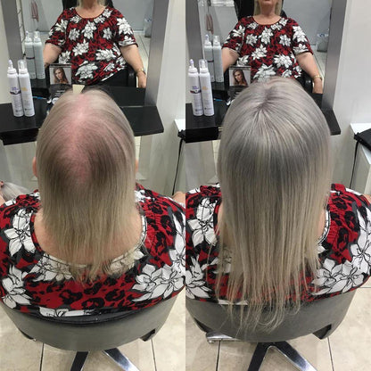 Monroe (Straight) | 100% Remy Hair Topper | Before and After