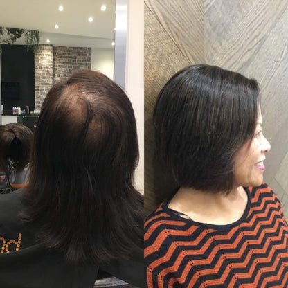 Marie | 100% Remy Hair Topper | Before and After